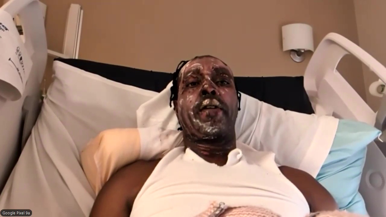 Tony Rodriguez, food truck owner, recovering from explosion incident